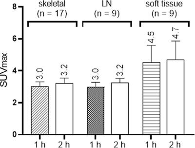 False Positive Findings of [18F]PSMA-1007 PET/CT in Patients After Radical Prostatectomy with Undetectable Serum PSA Levels